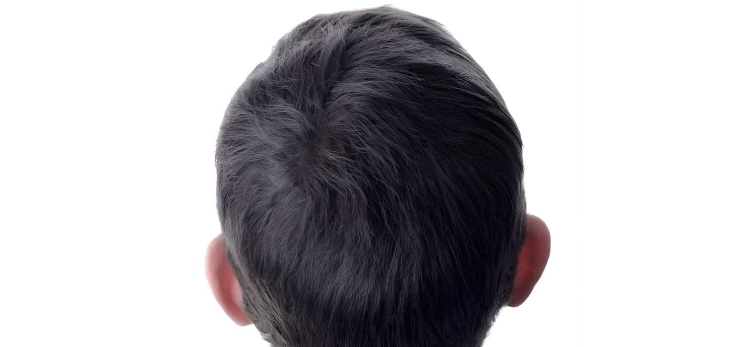 image comparison after